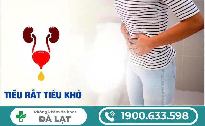 Hình ảnh minh họa